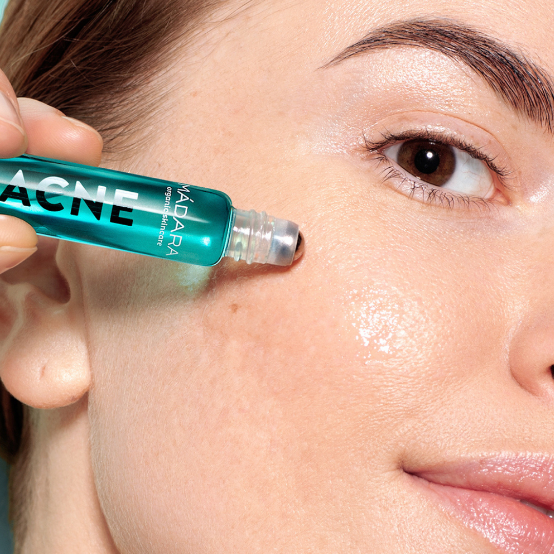 Madara Acne Acute Spot Roll-On auttaa taistelemaan finnejä vastaan.