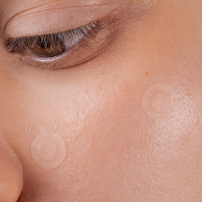 Scandy Spot the F Off Invisible Blemish Patches, finnilaastari, 24 kpl, ihonhoito, kauneus, kosmetiikka, koostumus, sinunapteekki.fi